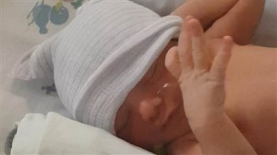 مستشفى الكورنيش يعالج 100 جنين داخل الرحم