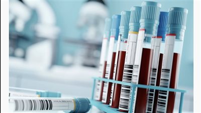 أبوظبي تقدم اختبار الخزعة السائلة للكشف عن سرطان القولون والمستقيم